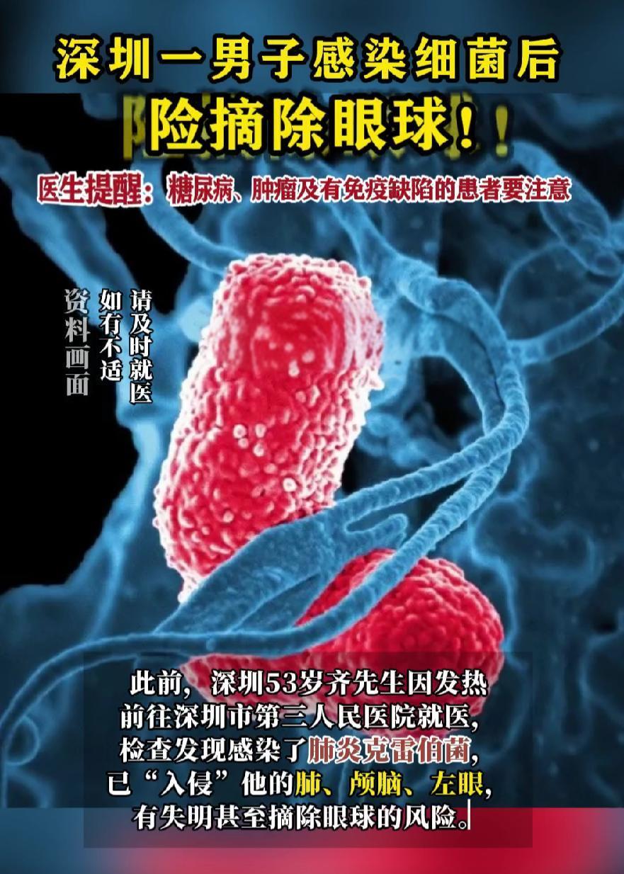 男子被细菌入侵脑肺 险摘除眼球 成功抗击罕见肺炎克雷伯菌感染